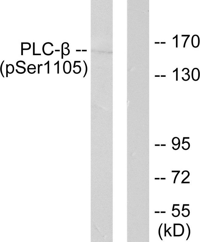 PLCB3 Antibody - Western blot analysis of lysates from A431 cells, using PLCB3 (Phospho-Ser1105) Antibody. The lane on the right is blocked with the phospho peptide.