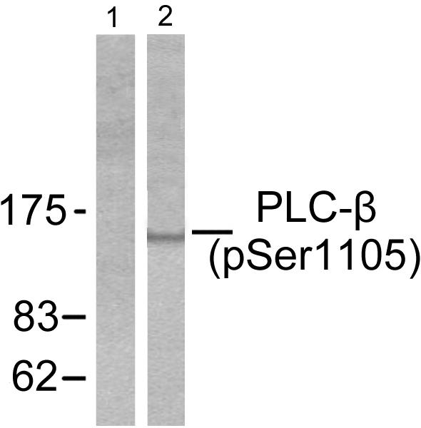 PLCB3 Antibody - Western blot analysis of extracts from A431 cells, using PLC-ß (phospho-Ser1105) antibody.