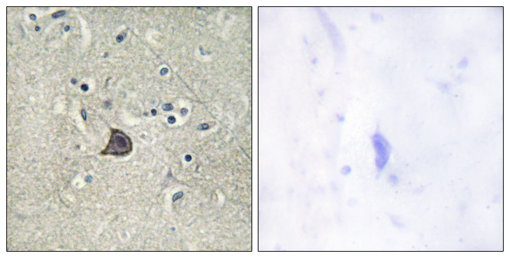 PLCB3 Antibody - Immunohistochemistry analysis of paraffin-embedded human brain, using PLC beta3 (Phospho-Ser537) Antibody. The picture on the right is blocked with the phospho peptide.