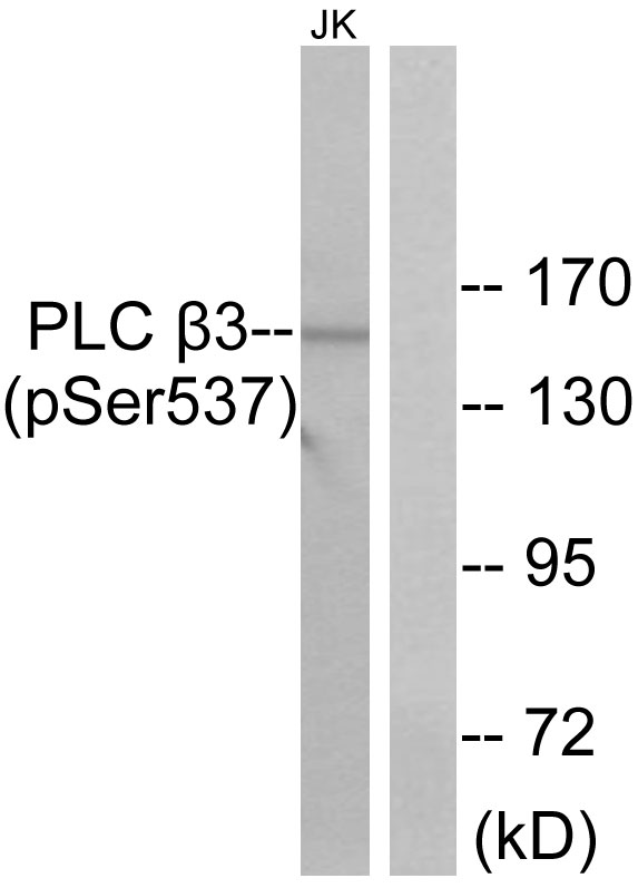 PLCB3 Antibody - Western blot analysis of lysates from Jurkat cells treated with UV 15', using PLC beta3 (Phospho-Ser537) Antibody. The lane on the right is blocked with the phospho peptide.