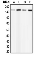 PLCB3 Antibody - Western blot analysis of PLC beta 3 (pS537) expression in HeLa PMA-treated (A); MCF7 UV-treated (B); mouse brain (C); rat brain (D) whole cell lysates.