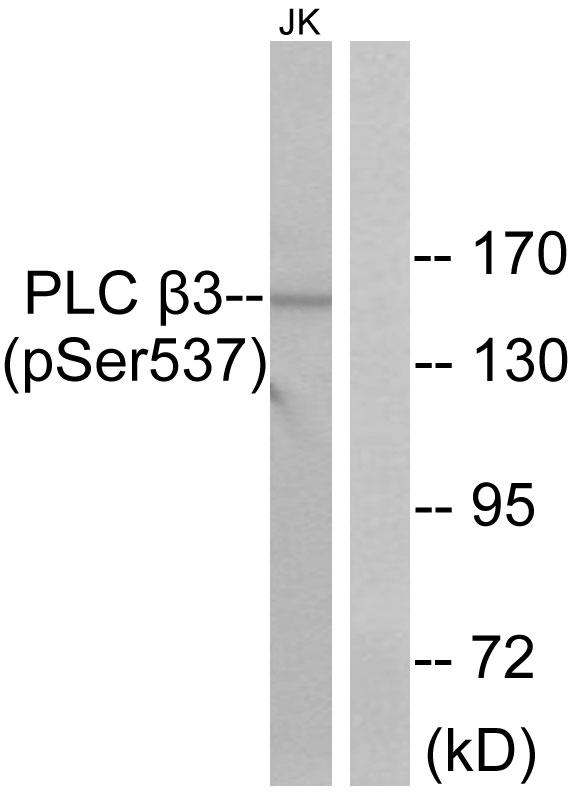 PLCB3 Antibody - Western blot analysis of extracts from Jurkat cells, treated with UV (15mins), using PLC ß3 (Phospho-Ser537) antibody.