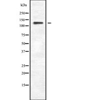 PLCB4 Antibody - Western blot analysis of PLCB4 expression in HEK293 cells. The lane on the left is treated with the antigen-specific peptide.
