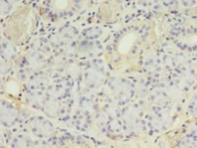 PLCD4 Antibody - Immunohistochemistry of paraffin-embedded human pancreas tissue using antibody at 1:100 dilution.  This image was taken for the unconjugated form of this product. Other forms have not been tested.