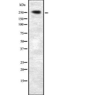 PLCE1 Antibody - Western blot analysis of PLCE1 expression in HEK293 cells. The lane on the left is treated with the antigen-specific peptide.
