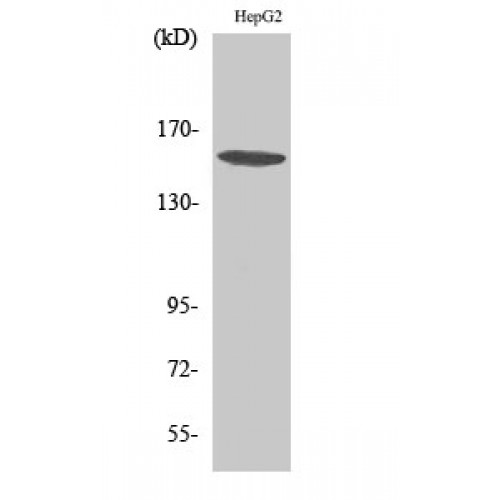 PLCG1 Antibody - Western blot of PLC gamma1 antibody