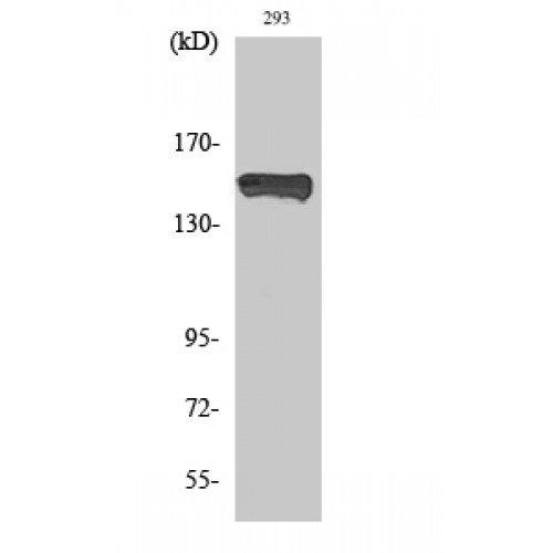 PLCG1 Antibody - Western blot of Phospho-PLC gamma1 (Y783) antibody