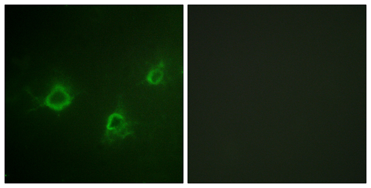 PLCG1 Antibody - Immunofluorescence analysis of COS7 cells, using PLCG1 Antibody. The picture on the right is blocked with the synthesized peptide.
