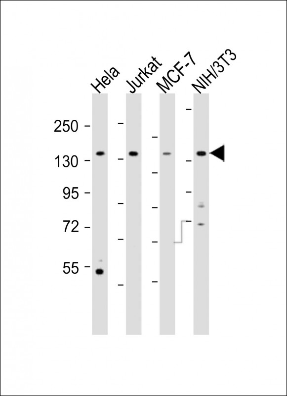 PLCG1 Antibody - All lanes: Anti-PLCG1 Antibody (Center) at 1:2000 dilution. Lane 1: HeLa whole cell lysates. Lane 2: Jurkat whole cell lysates. Lane 3: MCF-7 whole cell lysates. Lane 4: NIH/3T3 whole cell lysates Lysates/proteins at 20 ug per lane. Secondary Goat Anti-Rabbit IgG, (H+L), Peroxidase conjugated at 1:10000 dilution. Predicted band size: 149 kDa. Blocking/Dilution buffer: 5% NFDM/TBST.