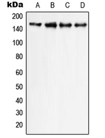 PLCG1 Antibody - Western blot analysis of PLC gamma 1 expression in HeLa (A); Raw264.7 (B); mouse colon (C); rat colon (D) whole cell lysates.