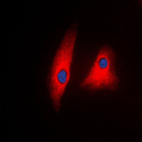 PLCG1 Antibody - Immunofluorescent analysis of PLC gamma 1 staining in Raw264.7 cells. Formalin-fixed cells were permeabilized with 0.1% Triton X-100 in TBS for 5-10 minutes and blocked with 3% BSA-PBS for 30 minutes at room temperature. Cells were probed with the primary antibody in 3% BSA-PBS and incubated overnight at 4 C in a humidified chamber. Cells were washed with PBST and incubated with a DyLight 594-conjugated secondary antibody (red) in PBS at room temperature in the dark. DAPI was used to stain the cell nuclei (blue).