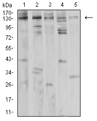 PLCG1 Antibody - Western blot analysis using PLCG1 mouse mAb against Jurkat (1), K562 (2), A431 (3), Hela (4), and PC-12 (5) cell lysate.