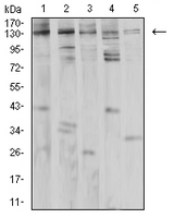 PLCG1 Antibody - Western blot analysis using PLCG1 mouse mAb against Jurkat (1), K562 (2), A431 (3), Hela (4), and PC-12 (5) cell lysate.