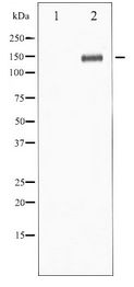 PLCG1 Antibody - Western blot of PLCG1 expression in EGF treated 293 whole cell lysates,The lane on the left is treated with the antigen-specific peptide.