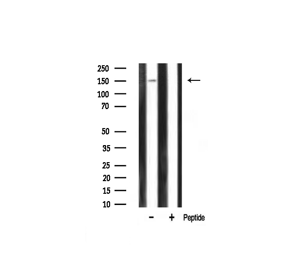 PLCG1 Antibody - Western blot analysis of PLCG1 expression in rat kidney tissue lysates. The lane on the right is treated with the antigen-specific peptide.