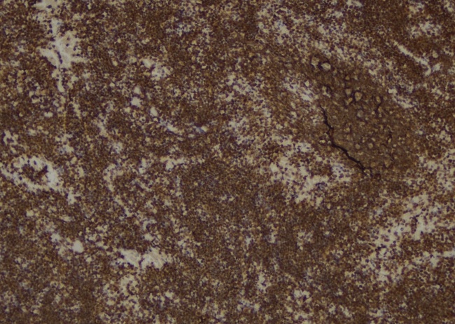 PLCG1 Antibody - 1:100 staining mouse spleen tissue by IHC-P. The sample was formaldehyde fixed and a heat mediated antigen retrieval step in citrate buffer was performed. The sample was then blocked and incubated with the antibody for 1.5 hours at 22°C. An HRP conjugated goat anti-rabbit antibody was used as the secondary.