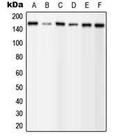 PLCG1 Antibody - Western blot analysis of PLC gamma 1 (pY1253) expression in MCF7 EGF-treated (A); A431 (B); mouse brain (C); mouse liver (D); H9C2 EGF-treated (E) whole cell lysates.