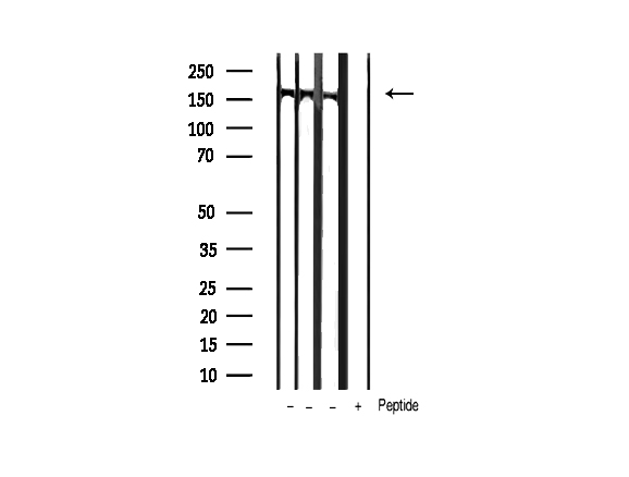 PLCG1 Antibody - Western blot analysis of extracts of various tissue sample using Phospho-PLCG1 (Tyr771) antibody.