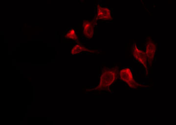 PLCG1 Antibody - Staining COS7 cells by IF/ICC. The samples were fixed with PFA and permeabilized in 0.1% Triton X-100, then blocked in 10% serum for 45 min at 25°C. The primary antibody was diluted at 1:200 and incubated with the sample for 1 hour at 37°C. An Alexa Fluor 594 conjugated goat anti-rabbit IgG (H+L) Ab, diluted at 1/600, was used as the secondary antibody.