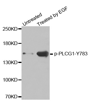 PLCG1 Antibody - Western blot analysis of extracts from HL60 cells.