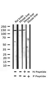 PLCG1 Antibody - Western blot analysis of Phospho-PLCG1 (Tyr783) expression in various lysates