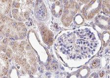 PLCG1 Antibody - 1:100 staining human kidney tissue by IHC-P. The tissue was formaldehyde fixed and a heat mediated antigen retrieval step in citrate buffer was performed. The tissue was then blocked and incubated with the antibody for 1.5 hours at 22°C. An HRP conjugated goat anti-rabbit antibody was used as the secondary.