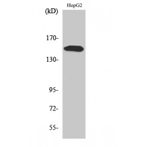 PLCG2 / PLC Gamma 2 Antibody - Western blot of Phospho-PLC gamma2 (Y753) antibody