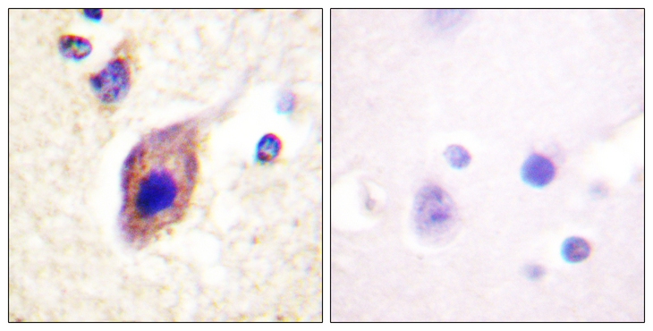 PLCG2 / PLC Gamma 2 Antibody - Immunohistochemistry analysis of paraffin-embedded human brain tissue, using PLCG2 Antibody. The picture on the right is blocked with the synthesized peptide.