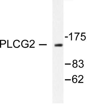 PLCG2 / PLC Gamma 2 Antibody - Western blot of PLCG2 (R747) pAb in extracts from COLO205 cells.
