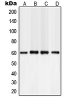 PLCG2 / PLC Gamma 2 Antibody - Western blot analysis of PLC gamma 2 expression in A549 (A); NIH3T3 (B); mouse brain (C); rat brain (D) whole cell lysates.