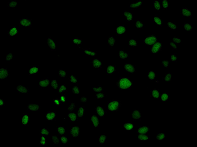 PLCG2 / PLC Gamma 2 Antibody - Immunofluorescence analysis of HeLa cell using PLCG2 antibody.