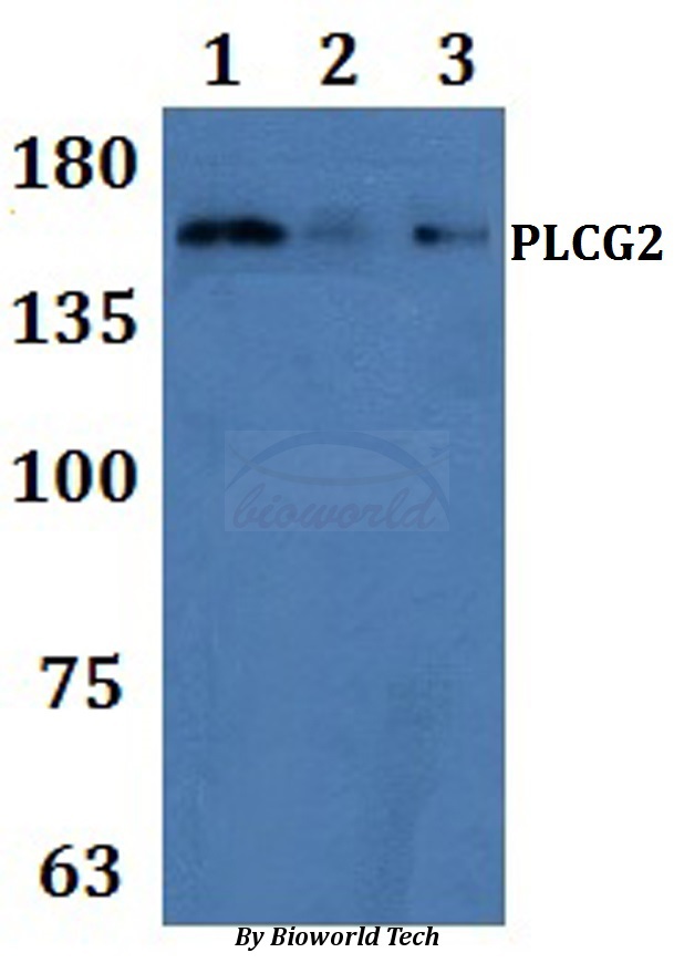 PLCG2 / PLC Gamma 2 Antibody - Western blot of PLC gamma 2 antibody at 1:500 Line1:HEK293T whole cell lysate Line2:H9C2 whole cell lysate Line3:Raw264.7 whole cell lysate.