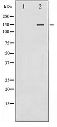PLCG2 / PLC Gamma 2 Antibody - Western blot of PLCG2 expression in COLO205 whole cell lysates,The lane on the left is treated with the antigen-specific peptide.