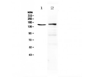 PLCG2 / PLC Gamma 2 Antibody - Western blot analysis of PLCG 2 using anti-PLCG 2 antibody