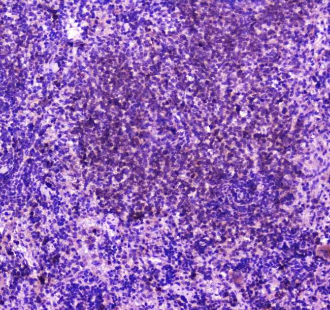 PLCG2 / PLC Gamma 2 Antibody - IHC analysis of PLCG 2 using anti-PLCG 2 antibody. PLCG 2 was detected in paraffin-embedded section of rat spleen tissue. Heat mediated antigen retrieval was performed in citrate buffer (pH6, epitope retrieval solution) for 20 mins. The tissue section was blocked with 10% goat serum. The tissue section was then incubated with 2µg/ml rabbit anti-PLCG 2 Antibody overnight at 4°C. Biotinylated goat anti-rabbit IgG was used as secondary antibody and incubated for 30 minutes at 37°C. The tissue section was developed using Strepavidin-Biotin-Complex (SABC) with DAB as the chromogen.
