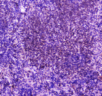 PLCG2 / PLC Gamma 2 Antibody - IHC analysis of PLCG 2 using anti-PLCG 2 antibody. PLCG 2 was detected in paraffin-embedded section of rat spleen tissue. Heat mediated antigen retrieval was performed in citrate buffer (pH6, epitope retrieval solution) for 20 mins. The tissue section was blocked with 10% goat serum. The tissue section was then incubated with 2µg/ml rabbit anti-PLCG 2 Antibody overnight at 4°C. Biotinylated goat anti-rabbit IgG was used as secondary antibody and incubated for 30 minutes at 37°C. The tissue section was developed using Strepavidin-Biotin-Complex (SABC) with DAB as the chromogen.