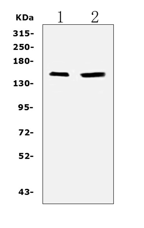 PLCG2 / PLC Gamma 2 Antibody - Western blot analysis of PLCG 2 using anti-PLCG 2 antibody. Electrophoresis was performed on a 5-20% SDS-PAGE gel at 70V (Stacking gel) / 90V (Resolving gel) for 2-3 hours. The sample well of each lane was loaded with 50ug of sample under reducing conditions. Lane 1: rat spleen tissue lysates, Lane 2: rat thymus tissue lysates. After Electrophoresis, proteins were transferred to a Nitrocellulose membrane at 150mA for 50-90 minutes. Blocked the membrane with 5% Non-fat Milk/ TBS for 1.5 hour at RT. The membrane was incubated with rabbit anti-PLCG 2 antigen affinity purified polyclonal antibody at 0.5 µg/mL overnight at 4°C, then washed with TBS-0.1% Tween 3 times with 5 minutes each and probed with a goat anti-rabbit IgG-HRP secondary antibody at a dilution of 1:10000 for 1.5 hour at RT. The signal is developed using an Enhanced Chemiluminescent detection (ECL) kit with Tanon 5200 system. A specific band was detected for PLCG 2 at approximately 25KD. The expected band size for PLCG 2 is at 25KD.