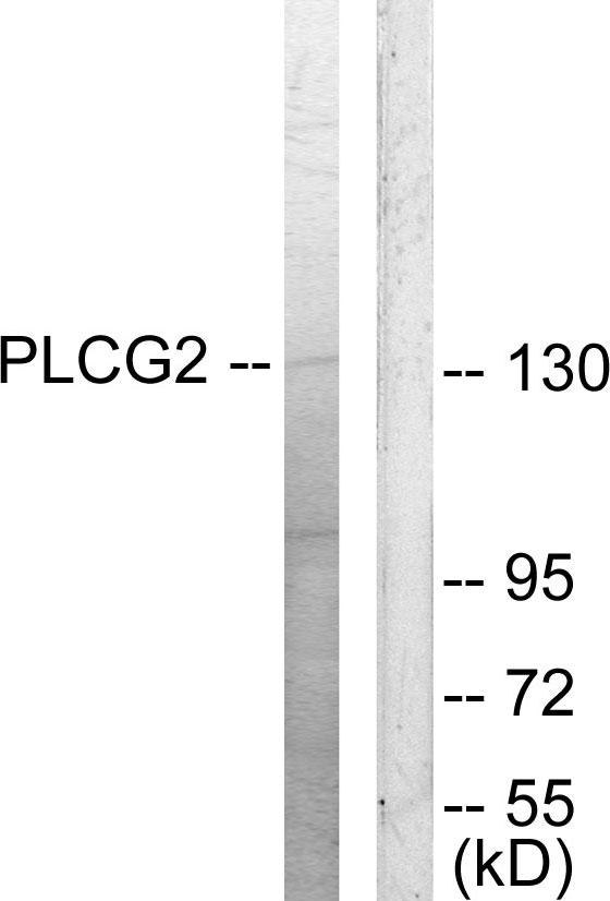 PLCG2 / PLC Gamma 2 Antibody - Western blot analysis of extracts from COLO205 cells, using PLCG2 (Ab-753) antibody.