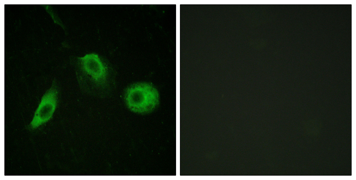PLCG2 / PLC Gamma 2 Antibody - Immunofluorescence analysis of HeLa cells, using PLCG2 (Phospho-Tyr1217) Antibody. The picture on the right is blocked with the phospho peptide.