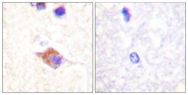 PLCG2 / PLC Gamma 2 Antibody - Immunohistochemistry analysis of paraffin-embedded human brain, using PLCG2 (Phospho-Tyr1217) Antibody. The picture on the right is blocked with the phospho peptide.