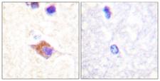 PLCG2 / PLC Gamma 2 Antibody - Immunohistochemistry analysis of paraffin-embedded human brain, using PLCG2 (Phospho-Tyr1217) Antibody. The picture on the right is blocked with the phospho peptide.
