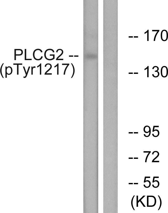 PLCG2 / PLC Gamma 2 Antibody - Western blot analysis of lysates from Jurkat cells treated with UV 15', using PLCG2 (Phospho-Tyr1217) Antibody. The lane on the right is blocked with the phospho peptide.