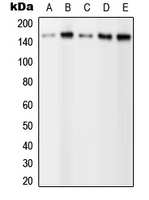 PLCG2 / PLC Gamma 2 Antibody - Western blot analysis of PLC gamma 2 (pY1217) expression in HEK293T EGF-treated (A); A431 (B); NIH3T3 (C); SP2/0 EGF-treated (D); H9C2 EGF-treated (E) whole cell lysates.