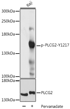 PLCG2 / PLC Gamma 2 Antibody - Western blot analysis of extracts of Raji cells, using Phospho-PLCG2-Y1217 antibody at 1:1000 dilution or PLCG2 antibody. Raji cells were treated by Pervanadate (1 mM) at 37â„ƒ for 30 minutes. The secondary antibody used was an HRP Goat Anti-Rabbit IgG (H+L) at 1:10000 dilution. Lysates were loaded 25ug per lane and 3% nonfat dry milk in TBST was used for blocking. Blocking buffer: 3% BSA.An ECL Kit was used for detection and the exposure time was 1s.
