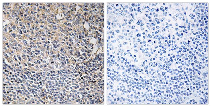 PLCG2 / PLC Gamma 2 Antibody - P-peptide - + Immunohistochemistry analysis of paraffin-embedded human tonsil tissue using PLCG2 (Phospho-Tyr1217) antibody.