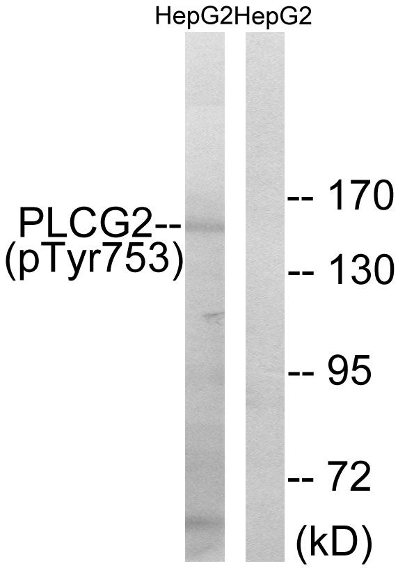 PLCG2 / PLC Gamma 2 Antibody - Western blot analysis of lysates from HepG2 cells treated with Na3VO4 0.3mM 40', using PLCG2 (Phospho-Tyr753) Antibody. The lane on the right is blocked with the phospho peptide.