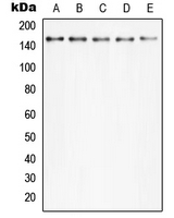 PLCG2 / PLC Gamma 2 Antibody - Western blot analysis of PLC gamma 2 (pY753) expression in HeLa TNFa-treated (A); MCF7 (B); Raw264.7 TNFa-treated (C); mouse kidney (D); rat kidney (E) whole cell lysates.