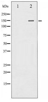 PLCG2 / PLC Gamma 2 Antibody - Western blot of PLCG2 phosphorylation expression in HepG2 whole cell lysates,The lane on the left is treated with the antigen-specific peptide.