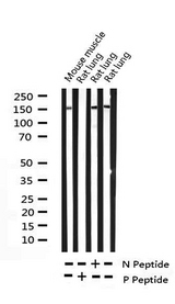 PLCG2 / PLC Gamma 2 Antibody - Western blot analysis of Phospho-PLCG2 (Tyr753) expression in various lysates