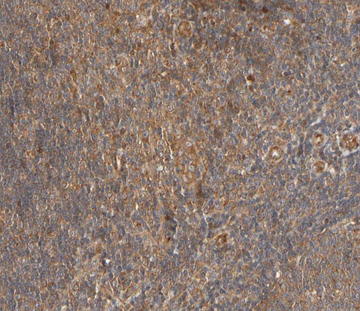 PLCG2 / PLC Gamma 2 Antibody - 1:200 staining human lymph node tissue by IHC-P. The tissue was formaldehyde fixed and a heat mediated antigen retrieval step in citrate buffer was performed. The tissue was then blocked and incubated with the antibody for 1.5 hours at 22°C. An HRP conjugated goat anti-rabbit antibody was used as the secondary.